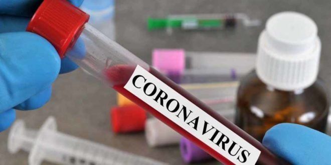 Coronavirus Lab